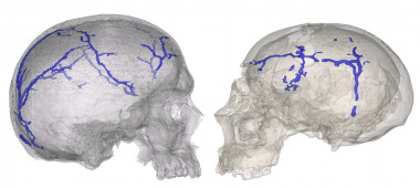 <p>Comparación del sistema vascular interno del cráneo de <em>Homo sapiens</em> y neandertal. / Rangel de Lazaro et al</p>