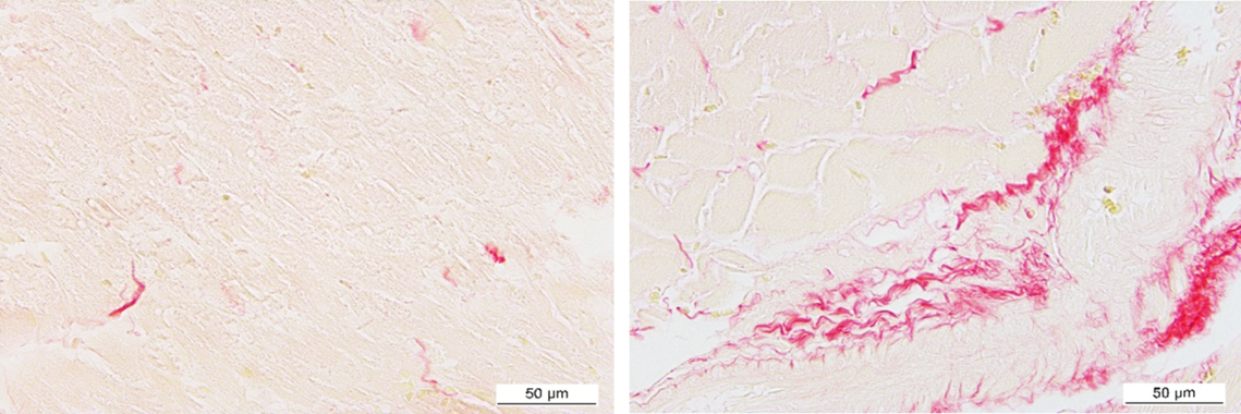 <p>Microfotografía representativa de secciones de corazón de ratas controles y ratas obesas, con tinción de rojo sirio que marca el contenido de colágeno. / Gutiérrez-Tenorio et al</p>