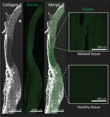 <p>Imagen representativa de microscopía multifoton para la evaluación de lesiones de ablación en la pared de las grandes arterias. / David Filgueiras</p>