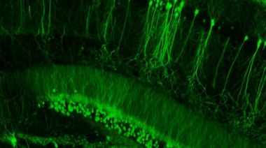 <p>Imagen de microscopía que muestra las células piramidales del hipocampo del ratón Thy1-EGFP. / UPF.</p>