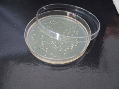 <p>Placa Petri con colonias de bacterias creciendo en un sustrato azaroso. / UGR.</p>