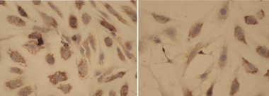 <p>Tinción de colágeno que compara modelos de mielofibrosis. A la izqda., las células sin tratar muestran presencia de fibrosis; a la dcha., células con disminución de la fibrosis tras haber sido sometidas a la terapia. / CNIO</p>