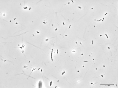 <p>Imagen de la microbiota fecal aislada vista al microscopio sin tinción fluorescente. / CSIC</p>