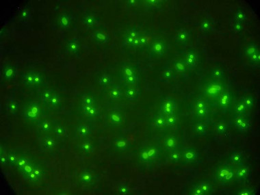 <p>Quistes y ooquistes vistos al microscopio de fluorescencia.<a href="http://www.agenciasinc.es/esl/imagenes/inicio/(imagen)/74784" target="_blank"> Imagen:</a> Laboratorio de Parasitología (INGACAL-Xunta de Galicia).</p>