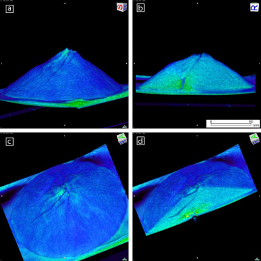 <p>Ejemplos de imágenes internas y externas de los experimentos obtenidas con el escáner de rayos-X, en las que se observa el magma (sirope) provocando las fracturas en el volcán. / URJC</p>