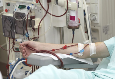 <p>La supervivencia de los receptores un año después del trasplante es superior que en los pacientes que continúan tratamiento con diálisis. / Adobe Stock</p>