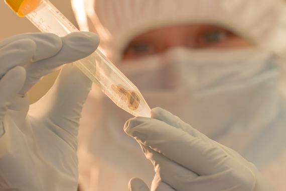 <p>Los investigadores obtuvieron el ADN bacteriano de los dientes de dos víctimas de la peste./ McMaster University</p>