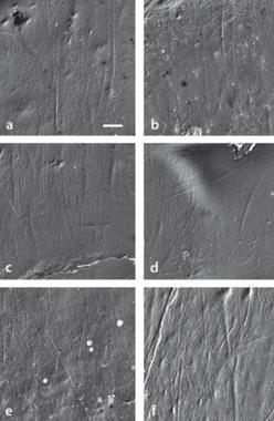 <p>Imagen de microscopía electrónica de rastreo del patrón de microestriación bucal de los especímenes estudiados de <em>A. anamensis</em>(a-e) y de <em>A. afarensis</em>.(f). Imagen: UB.</p>