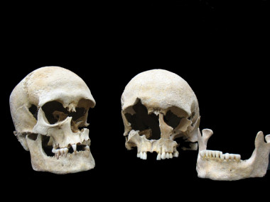 <p>Cráneos de víctimas de la peste enterradas juntas en una tumba en el cementerio Altenerding (Alemania). El genoma <em>Yersinia pestis</em> se extrajo del individuo de la derecha, una mujer de entre 25 y 30 años. El cráneo de la izquierda corresponde a un hombre de entre 20 y 25 años.</p>