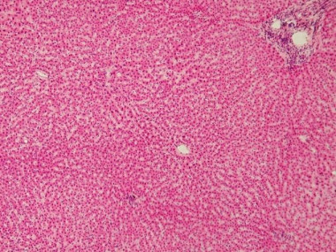 <p>En la imagen puede verse una microfotografía de células hepáticas. / <a href="https://upload.wikimedia.org/wikipedia/commons/f/fc/Human_liver.jpg" target="_blank">Wikipedia</a></p>