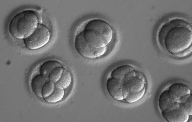 <p>Embriones dos días después de la coinyección de los componentes CRISPR con el esperma del donante. / OHSU</p>