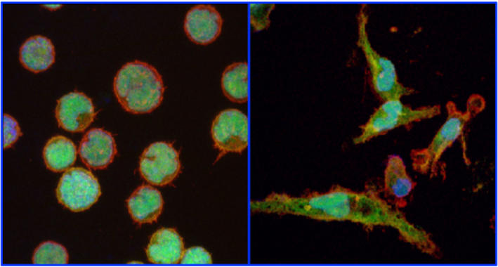 <p>A la izquierda, linfocitos cancerígenos. A la derecha, linfocitos reprogramados y convertidos en macrófagos. / Francesca Rapino, CRG.</p>