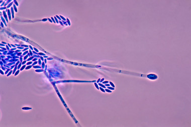 <p>Hongo<em> Fusarium verticillioide</em>. <a href="https://es.wikipedia.org/wiki/Fusarium#/media/File:Fusarium_verticillioides_01.jpg" target="_blank">Wikipedia</a></p>