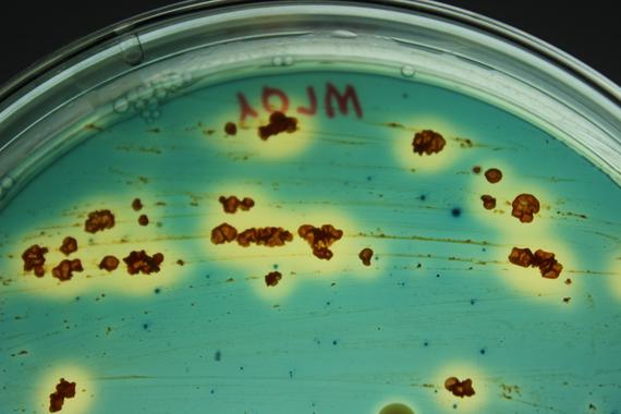 <p>Producción de sideróforos secretados por la bacteria <em>Micromonospora</em>./ Martha Trujillo.</p>
