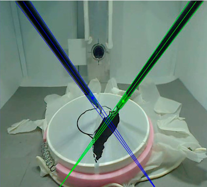 <p class=" text-left">Seguimiento del instrumental en un simulador a partir de análisis del vídeo endoscópico. / UPM</p>