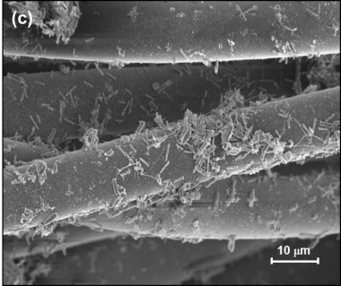 <p/>Imagen de microscopÃ­a de la tela analizada con bacterias adheridas a las fibras del tejido. / FundaciÃ³n Descubre” /><span style=