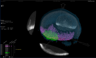 <p>Mapa del proceso de embriogéneis captado por los investigadores. / UPM</p>