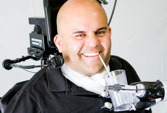 <p>Erik Sorto, el hombre al que se le ha implantado el brazo robótico. / Caltech</p>