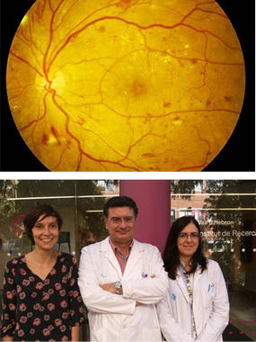 <p>Imagen de la retina en estadios iniciales de la retinopatía diabética y foto de los responsables del proyecto en el VHIR. De izquierda a derecha, Eila Van Reck, Dr. Rafael Simó y Dra. Cristina Hernández. / VHIR.</p>