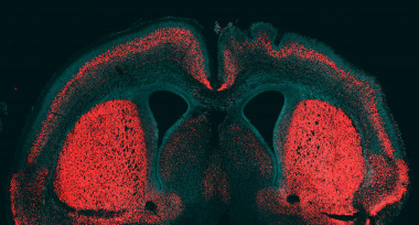 <p>Cortex embrionario de un ratón en el que se ha insertado el gen humano. En el hemisferio derecho se observa cómo se pliega la superficie del neocórtex. / Marta Florio y Wieland B. Huttner, Instituto Max Planck de Biología Celular, Molecular y Genética.</p>