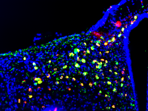 <p>Imagen de microscopía de fluorescencia del núcleo arcuado del hipotálamo donde se aprecian, en color verde, las neuronas POMC. / Alicia G Gómez-Valadés</p>