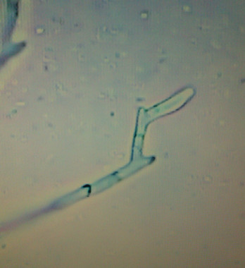 <p>El hongo patógeno <em>Fusarium circinatum</em> al microscopio./ Diana Bezos</p>