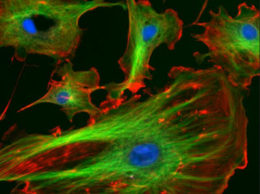 <p>Células endoteliales con el núcleo teñido de azul por un marcador fluorescente. / <a href="http://rsb.info.nih.gov/ij/images/" target="_blank">Wikipedia</a></p>