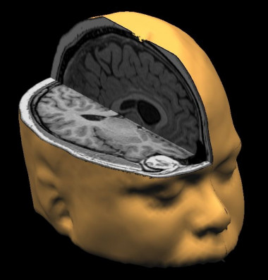 <p>Este trabajo explica los mecanismos biológicos por los cuales ciertos recuerdos se consolidan mientras que otros se olvidan/<a href="https://www.flickr.com/photos/digitalshotgun/454380458" target="_blank">Digital Shotgun</a></p>