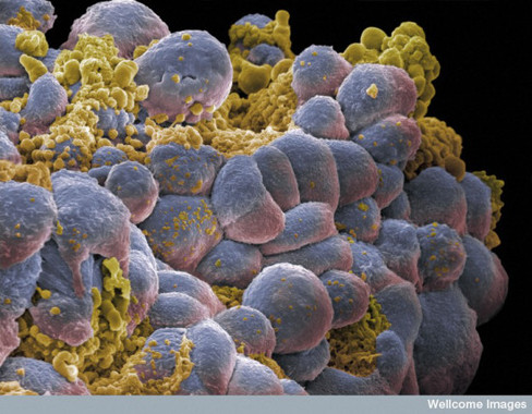 <p>Células cancerígenas. / Malena Aballay DEV</p>