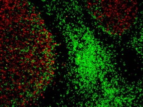 <p>Las técnicas de análisis de imágenes biológicas (<em>bioimaging</em>) permiten abordar problemas de difícil aproximación en ciencias de la vida. / UB</p>