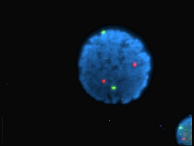 <p class=" text-left">Núcleo de un linfocito marcado con diversos colorantes fluorescentes. / Wikipedia</p>