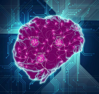 <p>El cerebro se muestra como una red compleja de interacciones, con la interrupción de las conexiones por las especies virales clave (HHV-6A, HHV-6B, HHV-7) identificadas en este estudio. / Readhead et al.</p>