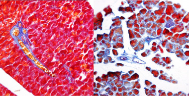 <p>Comparación pancreática, sin y con supresión del gen Wt1. / UMA</p>