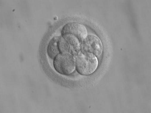 <p>Embrión humano tres días después de la fertilización. Imagen:<a href="http://en.wikipedia.org/wiki/Human_embryogenesis" target="_blank"> Wikipedia</a></p>