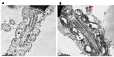 <p>Imágenes de microscopia electrónica de la pieza intermedia de espermatozoides humanos. A: sin tratamiento; B: con activador del proceso de autofagia. Las flechas marcan las vesículas autofágicas. M: mitocondria. / UEx</p>