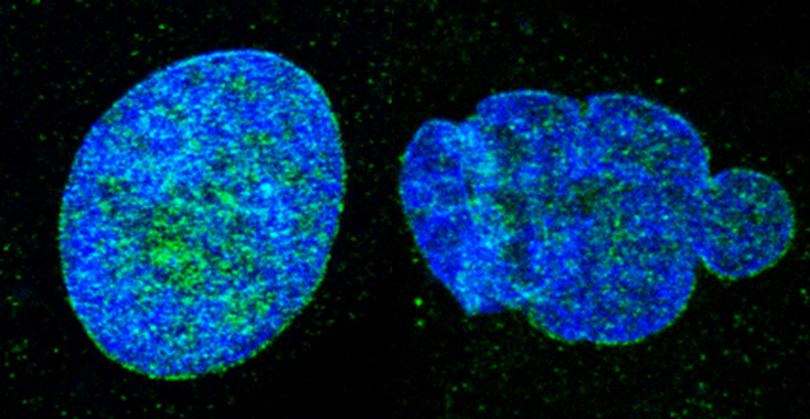 <p>Núcleos celulares de fibroblastos procedentes de un individuo sano (izquierda) y de un paciente afectado por el síndrome de Néstor-Guillermo (derecha). / <em>Nature Cell Biology</em></p>
