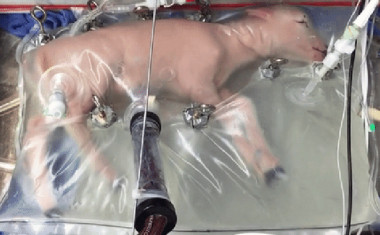 <p>Los corderos prematuros con los que se probó el prototipo eran fisiológicamente equivalentes a un bebé humano de 23 o 24 semanas de gestación. / CHOP</p>