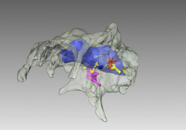 <p>Primera reconstrucción tridimensional del encéfalo de un dinosaurio hadrosaurio. / ICP.</p>