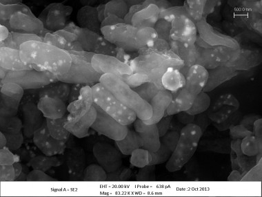 <p/>La bacteria <em>Klebsiella</em> sp. 3S1 tras la exposición a la plata. / Fundación Descubre ” /><span style=