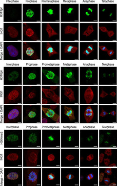 <p>Células en diferentes fases del ciclo cellular con marcaje en diferentes colores de las histonas modificadas y el ADN. / Karel van Wely, NAR, CNB-CSIC</p>