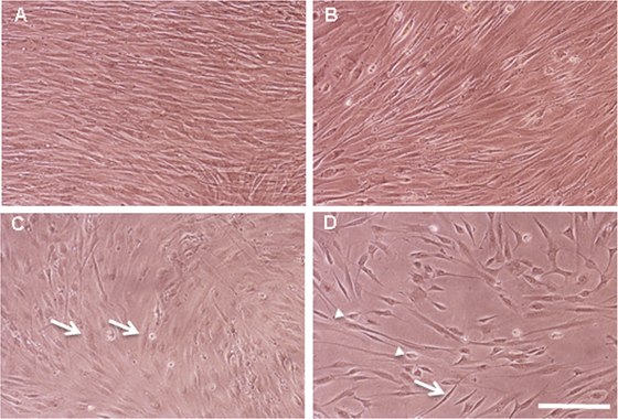 <p>Cultivos de fibroblastos humanos. / Durán <em>et al </em></p>