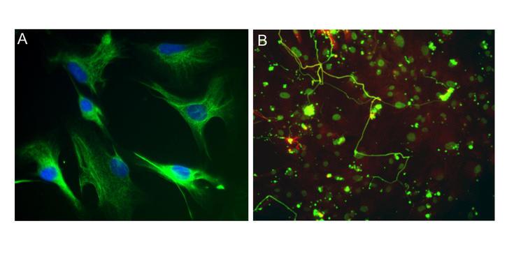 <p><strong>Figura (A):</strong> Línea de GE humana inmortalizada (x400). <strong>Figura (B):</strong> Regeneración de neuronas de retina adulta sobre línea de GE humana inmortalizada (x200)</p>
