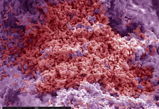 <p>Sin oxígeno, estas bacterias respiran gracias al sulfato presente en su entorno y han sido capaces de formar un yacimiento mineral inédito en el mundo. / Sinc.</p>