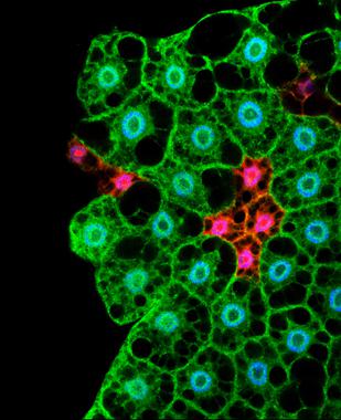 <p>Imagen de microscopía de células del cuerpo graso; en <em>Drosophila</em>, este es el tejido encargado de gestionar las reservas de energía. / Lara Barrio / IRB Barcelona</p>