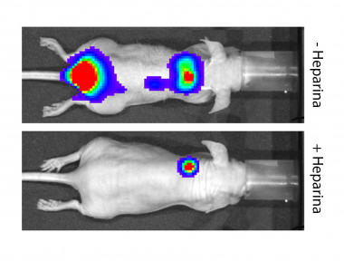 <p>El tratamiento de los ratones con heparina reduce las metástasis óseas y hepáticas. / UAM</p>