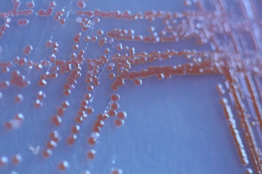 <p>Colonias de <em>Serratia marcescens</em>, una de las especies de bacterias utilizadas en el estudio, que crece en una placa de agar. / Deirdre McClean</p>