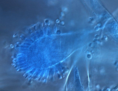 <p><em>Aspergillus giganteus</em> produce ribotoxinas que pueden ser empleadas con efectos beneficiosos / Belén Patiño</p>