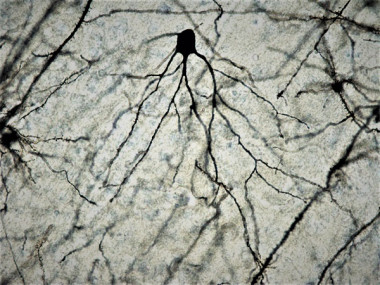 <p>Neurona de cerebro de ratón a 100x tras tinción de Golgi-Cox. / Facultad de Medicina UCM.</p>