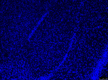 <p>Imagen de microscopía de una amígdala de ratón. / UPF</p>