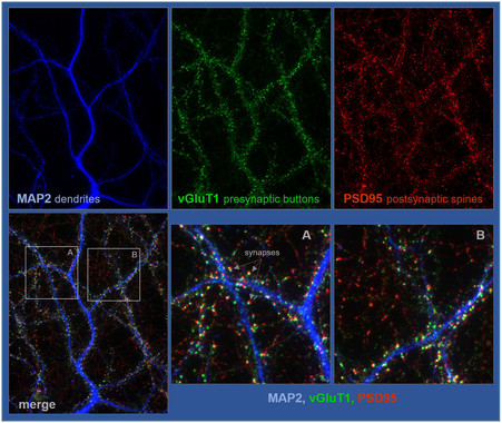<p>Detalle de neuronas de hipocampo crecidas durante 18 días, fijadas y procesadas para analizar sinapsis excitadoras. / UAM</p>